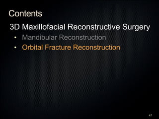 Contents
3D Maxillofacial Reconstructive Surgery
• Mandibular Reconstruction
• Orbital Fracture Reconstruction
47
 