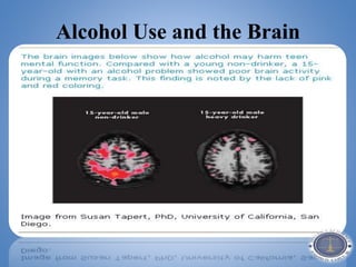 Alcohol Use and the Brain
 