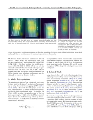 MURA Dataset: Towards Radiologist-Level Abnormality Detection in ...