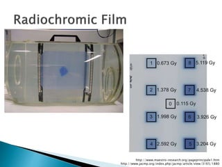 challenges of small field dosimetry | PPTX