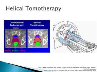 challenges of small field dosimetry | PPTX