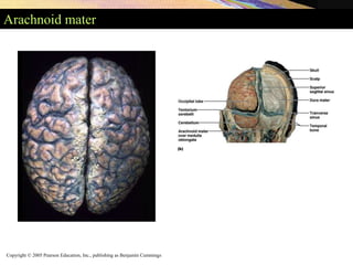 Copyright © 2005 Pearson Education, Inc., publishing as Benjamin Cummings
Arachnoid mater
 