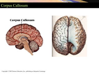 Copyright © 2005 Pearson Education, Inc., publishing as Benjamin Cummings
Corpus Callosum
 