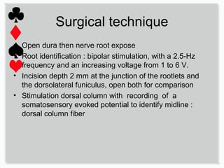 171&Sch ch130 Dorsal root entry zone lesion (DREZ) | PPT