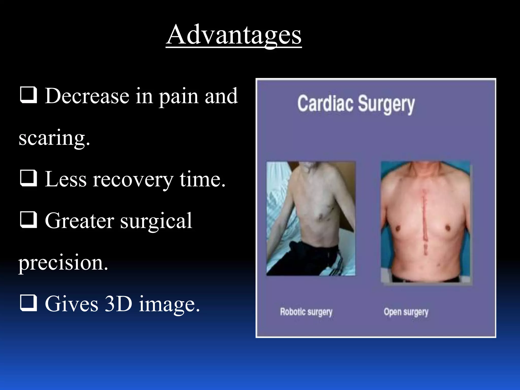 Advantages
 Decrease in pain and
scaring.
 Less recovery time.
 Greater surgical
precision.
 Gives 3D image.
 