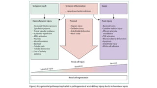 Diagnosis and Renal Replacement Therapy in Acute Kidney Injury (AKI ...