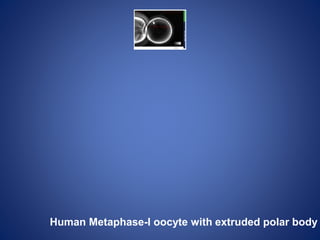 Human Metaphase-I oocyte with extruded polar body
 