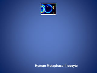 Human Metaphase-II oocyte
 