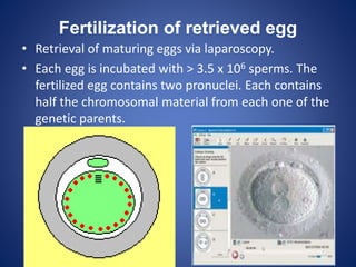 Fertilization of retrieved egg
• Retrieval of maturing eggs via laparoscopy.
• Each egg is incubated with > 3.5 x 106 sperms. The
fertilized egg contains two pronuclei. Each contains
half the chromosomal material from each one of the
genetic parents.
 