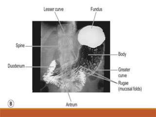 1727261612120_Gastrointestinal Radiology.pptx MBChB FINAL!!.pptx