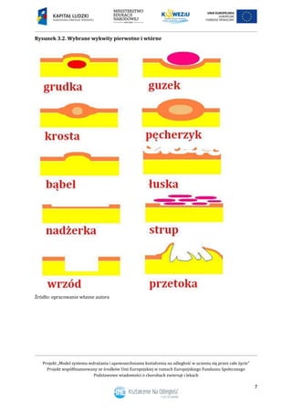 Projekt „Model systemu wdrażania i upowszechniania kształcenia na odległość w uczeniu się przez całe życie”
Projekt współfinansowany ze środków Unii Europejskiej w ramach Europejskiego Funduszu Społecznego
Podstawowe wiadomości o chorobach zwierząt i lekach
7
Rysunek 3.2. Wybrane wykwity pierwotne i wtórne
Źródło: opracowanie własne autora
 
