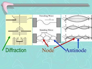   Diffraction     Node   Antinode 