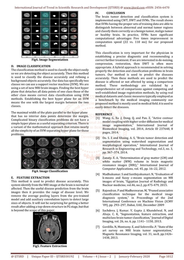 Tumor Detection And Classification Of Mri Brain Images Using Svm And Tumor Detection And Classification Of Mri Brain Images Using Svm And