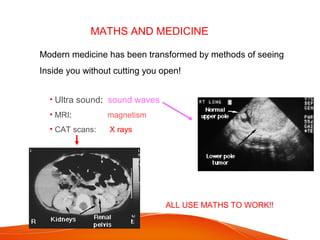 MATHS AND MEDICINE
Modern medicine has been transformed by methods of seeing
Inside you without cutting you open!
• Ultra sound: sound waves
• MRI: magnetism
• CAT scans: X rays
ALL USE MATHS TO WORK!!
 