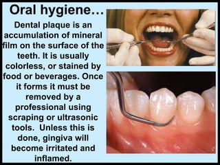 Oral hygiene…
Dental plaque is an
accumulation of mineral
film on the surface of the
teeth. It is usually
colorless, or stained by
food or beverages. Once
it forms it must be
removed by a
professional using
scraping or ultrasonic
tools. Unless this is
done, gingiva will
become irritated and
inflamed.
 