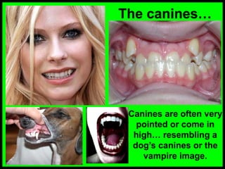 The canines…
Canines are often very
pointed or come in
high… resembling a
dog’s canines or the
vampire image.
 