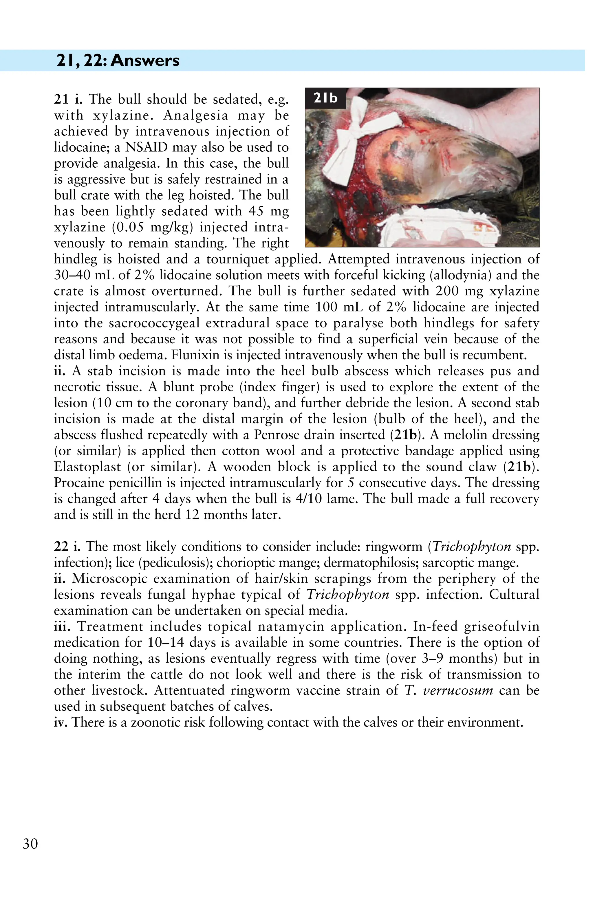 21, 22: Answers
30
22 i. The most likely conditions to consider include: ringworm (Trichophyton spp.
infection); lice (pediculosis); chorioptic mange; dermatophilosis; sarcoptic mange.
ii. Microscopic examination of hair/skin scrapings from the periphery of the
lesions reveals fungal hyphae typical of Trichophyton spp. infection. Cultural
examination can be undertaken on special media.
iii. Treatment includes topical natamycin application. In-feed griseofulvin
medication for 10–14 days is available in some countries. There is the option of
doing nothing, as lesions eventually regress with time (over 3–9 months) but in
the interim the cattle do not look well and there is the risk of transmission to
other livestock. Attentuated ringworm vaccine strain of T. verrucosum can be
used in subsequent batches of calves.
iv. There is a zoonotic risk following contact with the calves or their environment.
21 i. The bull should be sedated, e.g.
with xylazine. Analgesia may be
achieved by intravenous injection of
lidocaine; a NSAID may also be used to
provide analgesia. In this case, the bull
is aggressive but is safely restrained in a
bull crate with the leg hoisted. The bull
has been lightly sedated with 45 mg
xylazine (0.05 mg/kg) injected intra-
venously to remain standing. The right
hindleg is hoisted and a tourniquet applied. Attempted intravenous injection of
30–40 mL of 2% lidocaine solution meets with forceful kicking (allodynia) and the
crate is almost overturned. The bull is further sedated with 200 mg xylazine
injected intramuscularly. At the same time 100 mL of 2% lidocaine are injected
into the sacrococcygeal extradural space to paralyse both hindlegs for safety
reasons and because it was not possible to find a superficial vein because of the
distal limb oedema. Flunixin is injected intravenously when the bull is recumbent.
ii. A stab incision is made into the heel bulb abscess which releases pus and
necrotic tissue. A blunt probe (index finger) is used to explore the extent of the
lesion (10 cm to the coronary band), and further debride the lesion. A second stab
incision is made at the distal margin of the lesion (bulb of the heel), and the
abscess flushed repeatedly with a Penrose drain inserted (21b). A melolin dressing
(or similar) is applied then cotton wool and a protective bandage applied using
Elastoplast (or similar). A wooden block is applied to the sound claw (21b).
Procaine penicillin is injected intramuscularly for 5 consecutive days. The dressing
is changed after 4 days when the bull is 4/10 lame. The bull made a full recovery
and is still in the herd 12 months later.
21b
 