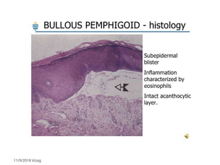 Bullous disorders in dermatology post graduate ppt | PPTX
