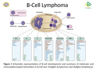 Modern Diagnostic and Personalized Treatment Approaches for Lymphoma | PPTX