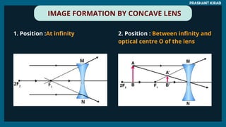 IMAGE FORMATION BY CONCAVE LENS
PRASHANT KIRAD
1. Position :At infinity 2. Position : Between infinity and
optical centre O of the lens
 