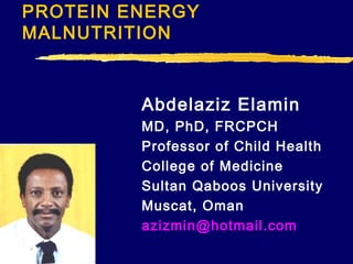 PROTEIN ENERGY
MALNUTRITION
Abdelaziz Elamin
MD, PhD, FRCPCH
Professor of Child Health
College of Medicine
Sultan Qaboos University
Muscat, Oman
azizmin@hotmail.com
 