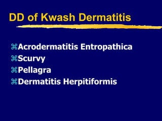 DD of Kwash Dermatitis
Acrodermatitis Entropathica
Scurvy
Pellagra
Dermatitis Herpitiformis
 