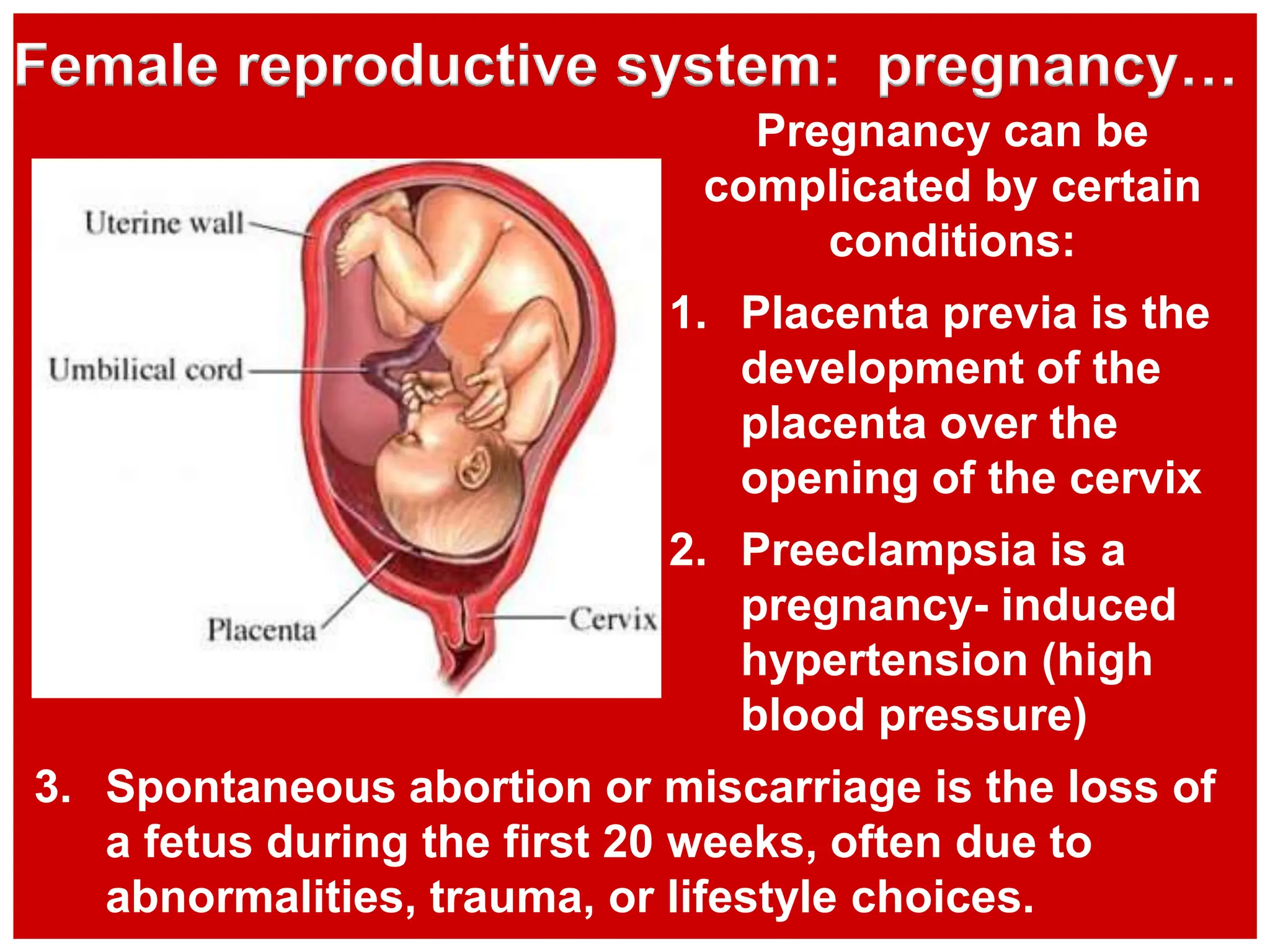 3. Spontaneous abortion or miscarriage is the loss of
a fetus during the first 20 weeks, often due to
abnormalities, trauma, or lifestyle choices.
Female reproductive system: pregnancy…
Pregnancy can be
complicated by certain
conditions:
1. Placenta previa is the
development of the
placenta over the
opening of the cervix
2. Preeclampsia is a
pregnancy- induced
hypertension (high
blood pressure)
 