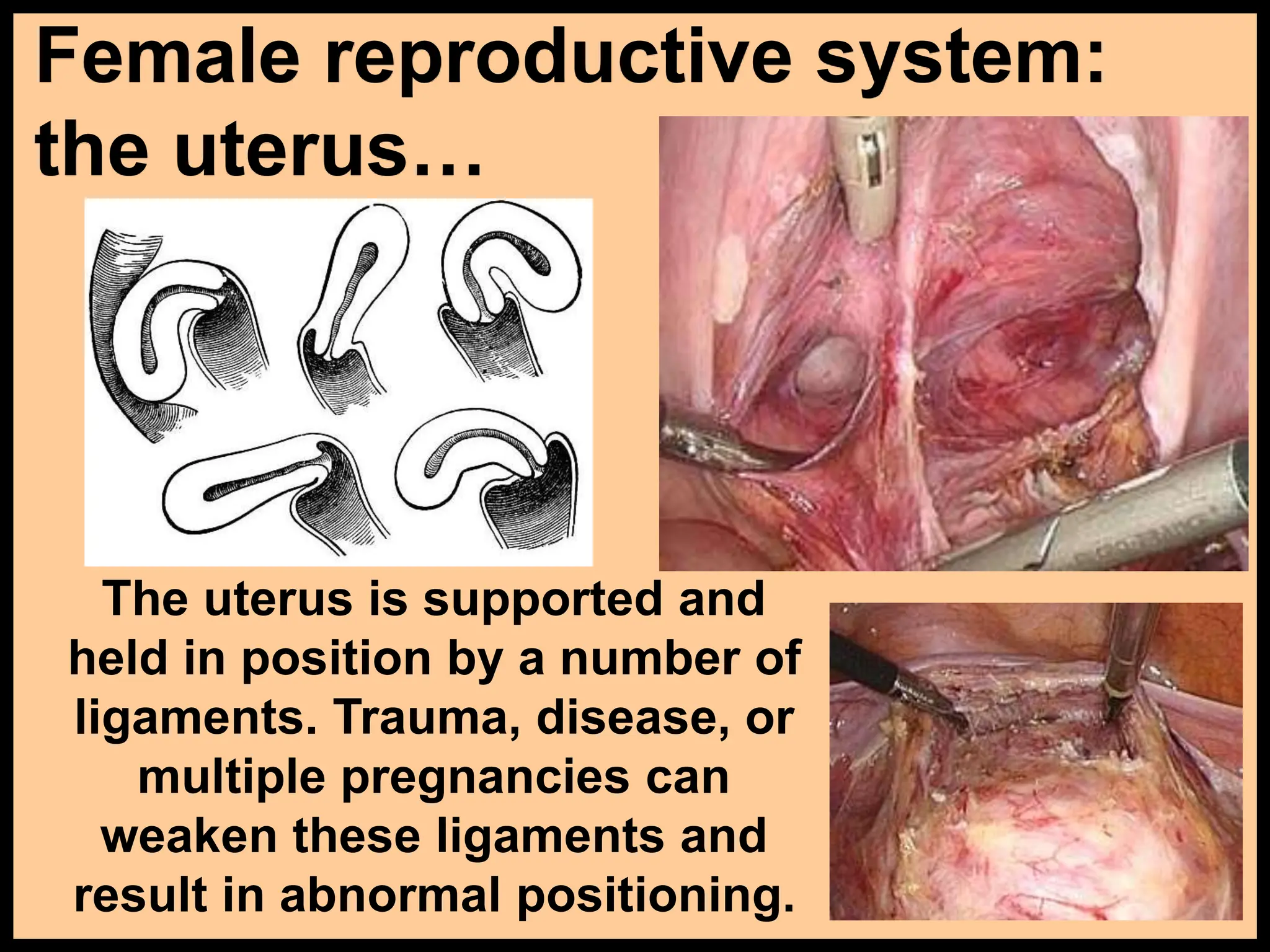 Female reproductive system:
the uterus…
The uterus is supported and
held in position by a number of
ligaments. Trauma, disease, or
multiple pregnancies can
weaken these ligaments and
result in abnormal positioning.
 