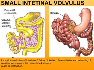 1780_DevelopmentofHindgut embryology of hindgut.ppsx