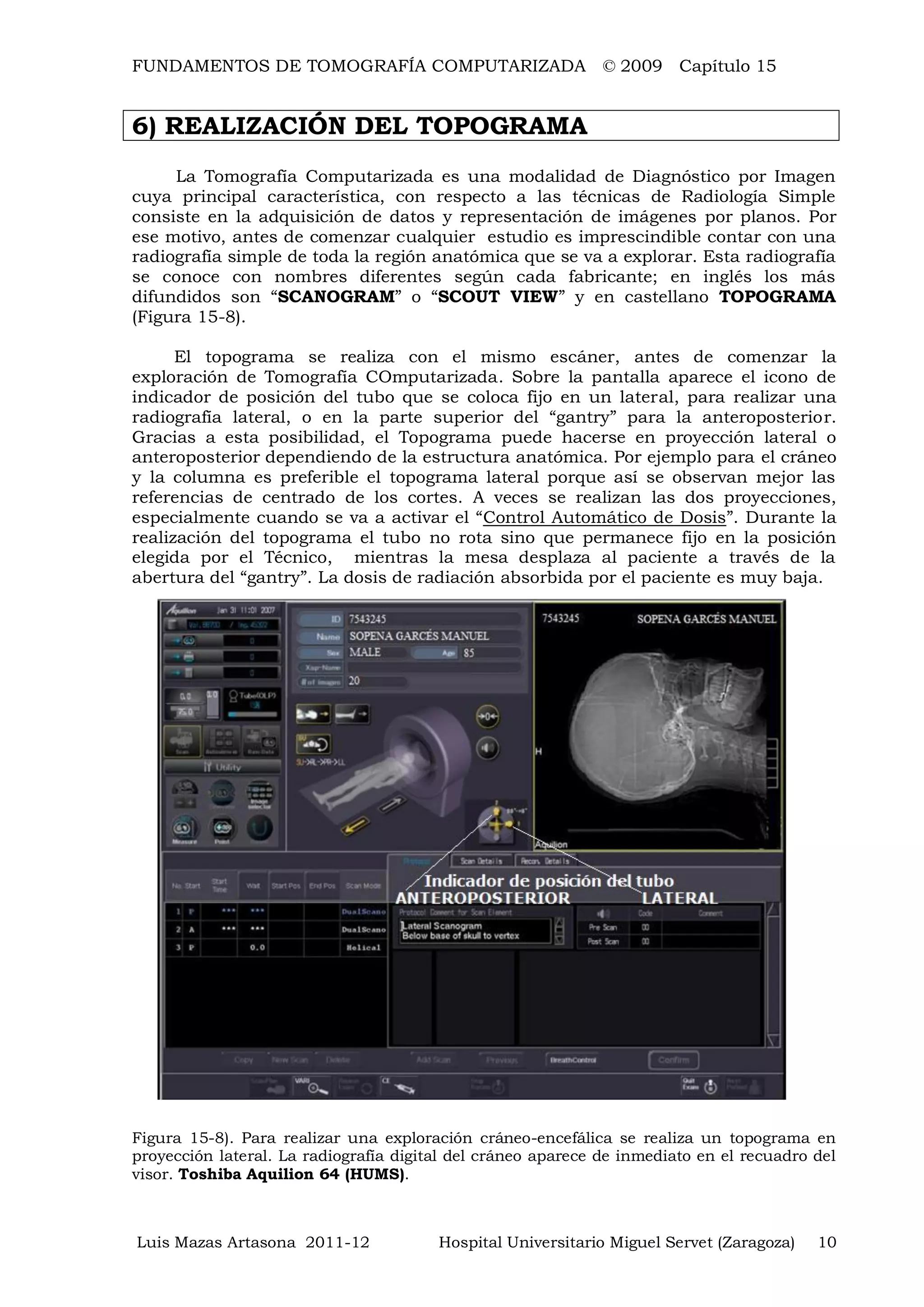 FUNDAMENTOS DE TOMOGRAFÍA COMPUTARIZADA © 2009 Capítulo 15
Luis Mazas Artasona 2011-12 Hospital Universitario Miguel Servet (Zaragoza) 10
6) REALIZACIÓN DEL TOPOGRAMA
La Tomografía Computarizada es una modalidad de Diagnóstico por Imagen
cuya principal característica, con respecto a las técnicas de Radiología Simple
consiste en la adquisición de datos y representación de imágenes por planos. Por
ese motivo, antes de comenzar cualquier estudio es imprescindible contar con una
radiografía simple de toda la región anatómica que se va a explorar. Esta radiografía
se conoce con nombres diferentes según cada fabricante; en inglés los más
difundidos son “SCANOGRAM” o “SCOUT VIEW” y en castellano TOPOGRAMA
(Figura 15-8).
El topograma se realiza con el mismo escáner, antes de comenzar la
exploración de Tomografía COmputarizada. Sobre la pantalla aparece el icono de
indicador de posición del tubo que se coloca fijo en un lateral, para realizar una
radiografía lateral, o en la parte superior del “gantry” para la anteroposterior.
Gracias a esta posibilidad, el Topograma puede hacerse en proyección lateral o
anteroposterior dependiendo de la estructura anatómica. Por ejemplo para el cráneo
y la columna es preferible el topograma lateral porque así se observan mejor las
referencias de centrado de los cortes. A veces se realizan las dos proyecciones,
especialmente cuando se va a activar el “Control Automático de Dosis”. Durante la
realización del topograma el tubo no rota sino que permanece fijo en la posición
elegida por el Técnico, mientras la mesa desplaza al paciente a través de la
abertura del “gantry”. La dosis de radiación absorbida por el paciente es muy baja.
Figura 15-8). Para realizar una exploración cráneo-encefálica se realiza un topograma en
proyección lateral. La radiografía digital del cráneo aparece de inmediato en el recuadro del
visor. Toshiba Aquilion 64 (HUMS).
 