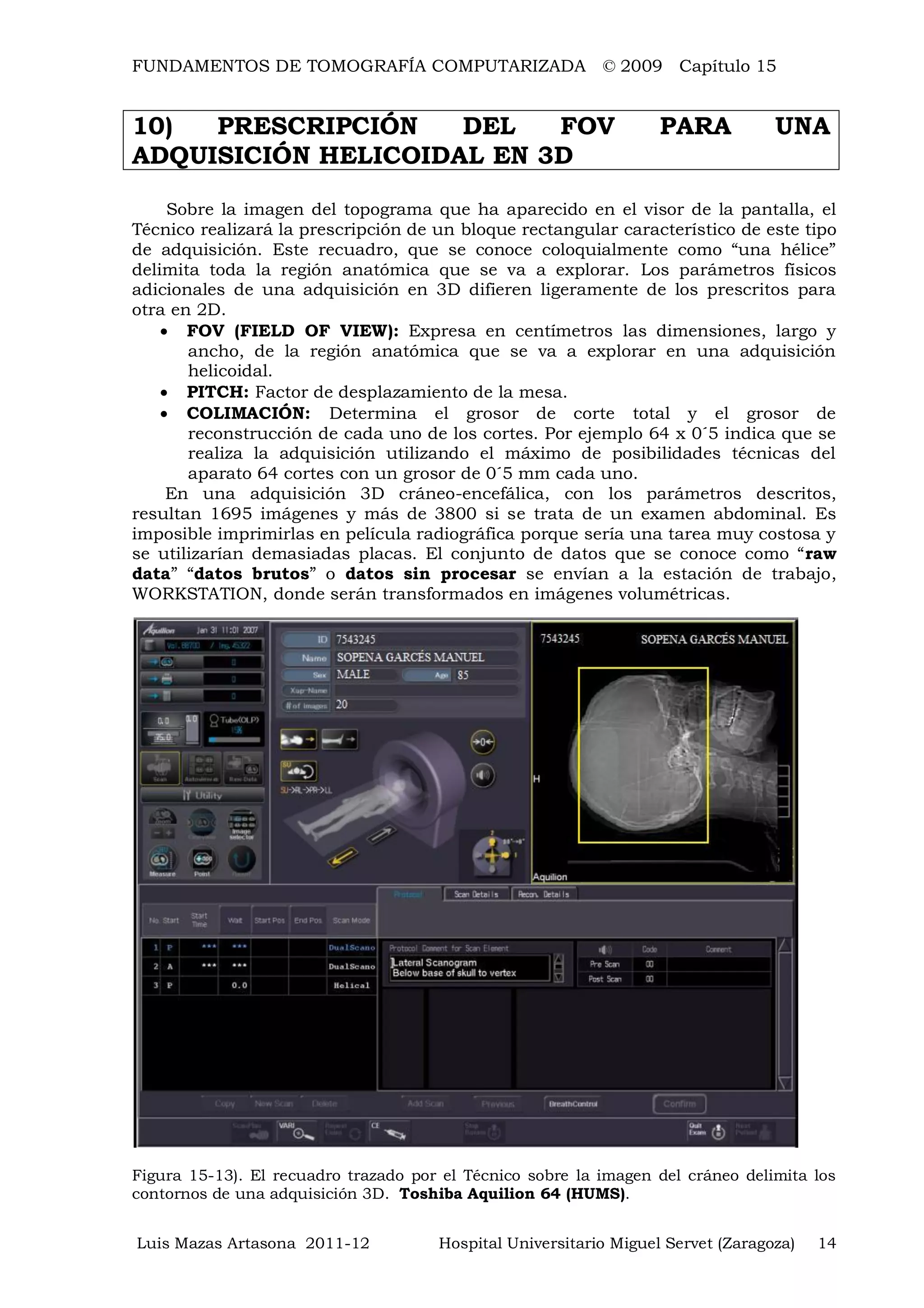 FUNDAMENTOS DE TOMOGRAFÍA COMPUTARIZADA © 2009 Capítulo 15
Luis Mazas Artasona 2011-12 Hospital Universitario Miguel Servet (Zaragoza) 14
10) PRESCRIPCIÓN DEL FOV PARA UNA
ADQUISICIÓN HELICOIDAL EN 3D
Sobre la imagen del topograma que ha aparecido en el visor de la pantalla, el
Técnico realizará la prescripción de un bloque rectangular característico de este tipo
de adquisición. Este recuadro, que se conoce coloquialmente como “una hélice”
delimita toda la región anatómica que se va a explorar. Los parámetros físicos
adicionales de una adquisición en 3D difieren ligeramente de los prescritos para
otra en 2D.
 FOV (FIELD OF VIEW): Expresa en centímetros las dimensiones, largo y
ancho, de la región anatómica que se va a explorar en una adquisición
helicoidal.
 PITCH: Factor de desplazamiento de la mesa.
 COLIMACIÓN: Determina el grosor de corte total y el grosor de
reconstrucción de cada uno de los cortes. Por ejemplo 64 x 0´5 indica que se
realiza la adquisición utilizando el máximo de posibilidades técnicas del
aparato 64 cortes con un grosor de 0´5 mm cada uno.
En una adquisición 3D cráneo-encefálica, con los parámetros descritos,
resultan 1695 imágenes y más de 3800 si se trata de un examen abdominal. Es
imposible imprimirlas en película radiográfica porque sería una tarea muy costosa y
se utilizarían demasiadas placas. El conjunto de datos que se conoce como “raw
data” “datos brutos” o datos sin procesar se envían a la estación de trabajo,
WORKSTATION, donde serán transformados en imágenes volumétricas.
Figura 15-13). El recuadro trazado por el Técnico sobre la imagen del cráneo delimita los
contornos de una adquisición 3D. Toshiba Aquilion 64 (HUMS).
 