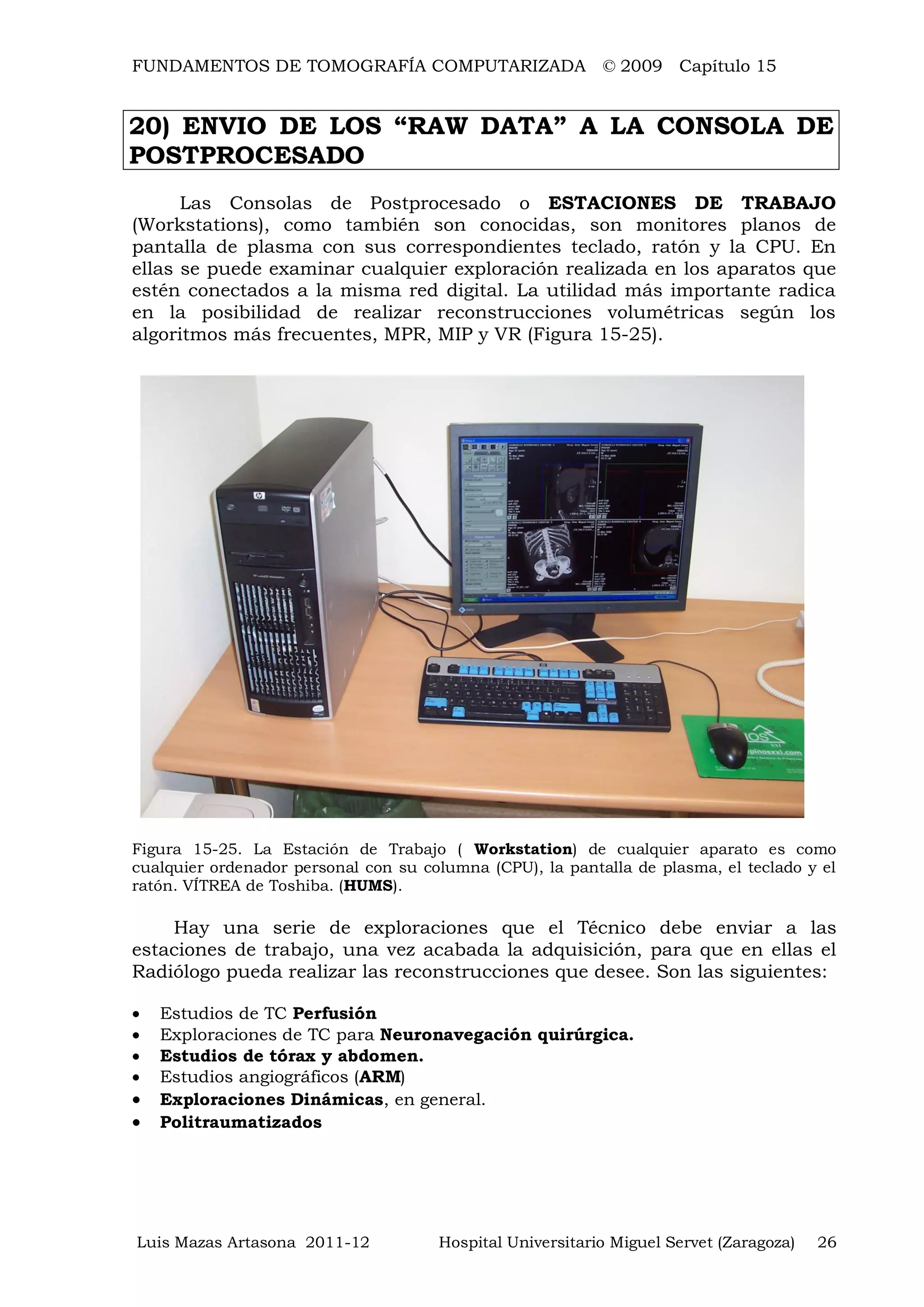 FUNDAMENTOS DE TOMOGRAFÍA COMPUTARIZADA © 2009 Capítulo 15
Luis Mazas Artasona 2011-12 Hospital Universitario Miguel Servet (Zaragoza) 26
20) ENVIO DE LOS “RAW DATA” A LA CONSOLA DE
POSTPROCESADO
Las Consolas de Postprocesado o ESTACIONES DE TRABAJO
(Workstations), como también son conocidas, son monitores planos de
pantalla de plasma con sus correspondientes teclado, ratón y la CPU. En
ellas se puede examinar cualquier exploración realizada en los aparatos que
estén conectados a la misma red digital. La utilidad más importante radica
en la posibilidad de realizar reconstrucciones volumétricas según los
algoritmos más frecuentes, MPR, MIP y VR (Figura 15-25).
Figura 15-25. La Estación de Trabajo ( Workstation) de cualquier aparato es como
cualquier ordenador personal con su columna (CPU), la pantalla de plasma, el teclado y el
ratón. VÍTREA de Toshiba. (HUMS).
Hay una serie de exploraciones que el Técnico debe enviar a las
estaciones de trabajo, una vez acabada la adquisición, para que en ellas el
Radiólogo pueda realizar las reconstrucciones que desee. Son las siguientes:
 Estudios de TC Perfusión
 Exploraciones de TC para Neuronavegación quirúrgica.
 Estudios de tórax y abdomen.
 Estudios angiográficos (ARM)
 Exploraciones Dinámicas, en general.
 Politraumatizados
 
