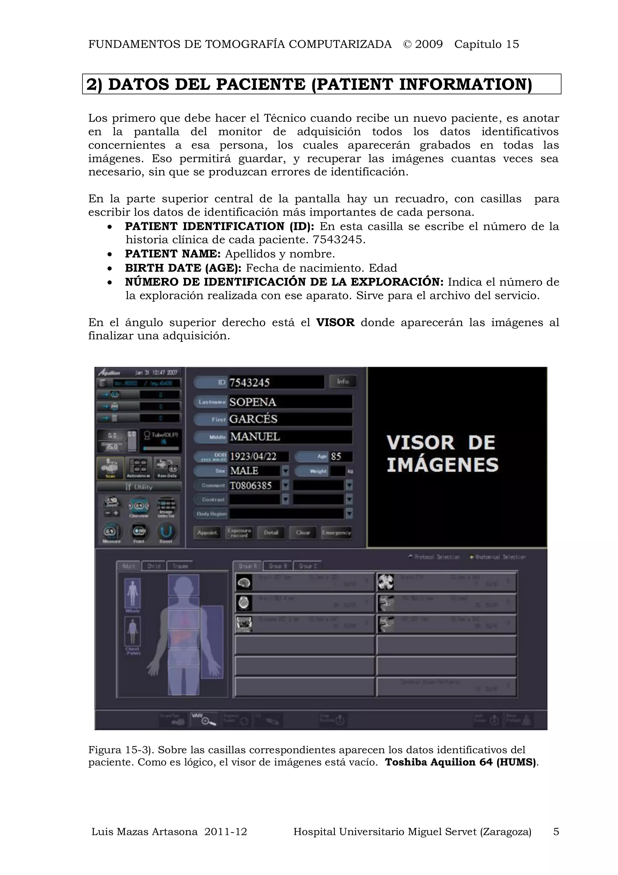 FUNDAMENTOS DE TOMOGRAFÍA COMPUTARIZADA © 2009 Capítulo 15
Luis Mazas Artasona 2011-12 Hospital Universitario Miguel Servet (Zaragoza) 5
2) DATOS DEL PACIENTE (PATIENT INFORMATION)
Los primero que debe hacer el Técnico cuando recibe un nuevo paciente, es anotar
en la pantalla del monitor de adquisición todos los datos identificativos
concernientes a esa persona, los cuales aparecerán grabados en todas las
imágenes. Eso permitirá guardar, y recuperar las imágenes cuantas veces sea
necesario, sin que se produzcan errores de identificación.
En la parte superior central de la pantalla hay un recuadro, con casillas para
escribir los datos de identificación más importantes de cada persona.
 PATIENT IDENTIFICATION (ID): En esta casilla se escribe el número de la
historia clínica de cada paciente. 7543245.
 PATIENT NAME: Apellidos y nombre.
 BIRTH DATE (AGE): Fecha de nacimiento. Edad
 NÚMERO DE IDENTIFICACIÓN DE LA EXPLORACIÓN: Indica el número de
la exploración realizada con ese aparato. Sirve para el archivo del servicio.
En el ángulo superior derecho está el VISOR donde aparecerán las imágenes al
finalizar una adquisición.
Figura 15-3). Sobre las casillas correspondientes aparecen los datos identificativos del
paciente. Como es lógico, el visor de imágenes está vacío. Toshiba Aquilion 64 (HUMS).
 