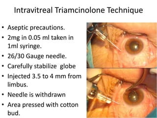 Limbus Injected irvine gass syndrome | PPT