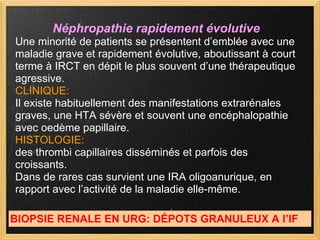 Néphropathie rapidement évolutive Une minorité de patients se présentent d’emblée avec une maladie grave et rapidement évolutive, aboutissant à court terme à IRCT en dépit le plus souvent d’une thérapeutique agressive. CLINIQUE: Il existe habituellement des manifestations extrarénales graves, une HTA sévère et souvent une encéphalopathie avec oedème papillaire.  HISTOLOGIE:   des thrombi capillaires disséminés et parfois des croissants. Dans de rares cas survient une IRA oligoanurique, en rapport avec l’activité de la maladie elle-même. BIOPSIE RENALE EN URG: DÉPOTS GRANULEUX A l’IF 