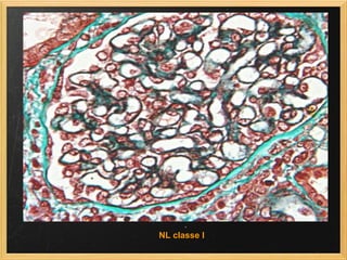 NL classe I 