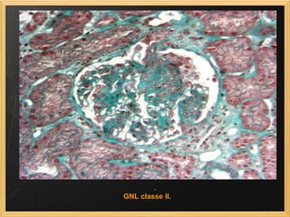 GNL classe II.  