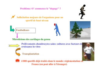 Problème: Où commence le "dopage" ?    Sollicitation majeure de l'organisme pour un sportif de haut niveau Footballeurs Microlésions des cartilages du genou Prélèvements chondrocytes sains: cultures avec facteurs de croissance in vitro Transplantation    4 000 sportifs déjà traités dans le monde: réglementation en France (on peut aller à l'étranger) 