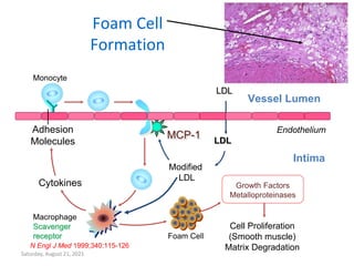 Saturday, August 21, 2021
Foam Cell
Formation
N Engl J Med 1999;340:115-126
LDL
LDL
Endothelium
Vessel Lumen
Monocyte
Macrophage
Scavenger
receptor
Adhesion
Molecules
Foam Cell
Intima
Modified
LDL
Cytokines
Cell Proliferation
(Smooth muscle)
Matrix Degradation
Growth Factors
Metalloproteinases
MCP-1
 