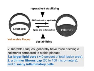 Vulnerable Plaques generally have three histologic
hallmarks compared to stable plaques
1.a larger lipid core (>40 percent of total lesion area),
2. a thinner fibrous cap (65 to 150 micro-meters),
and 3. many inflammatory cells
Vulnerable Plaque
 