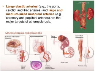 • Large elastic arteries (e.g., the aorta,
carotid, and iliac arteries) and large and
medium-sized muscular arteries (e.g.,
coronary and popliteal arteries) are the
major targets of atherosclerosis.
 