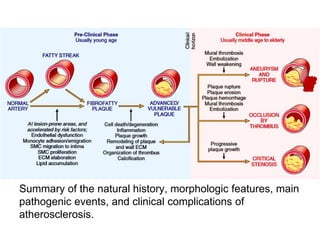 Summary of the natural history, morphologic features, main
pathogenic events, and clinical complications of
atherosclerosis.
 