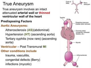 17971_27.2_Aneurysm.ppt