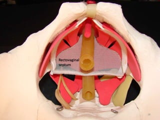 Rectovaginal
septum
28
 