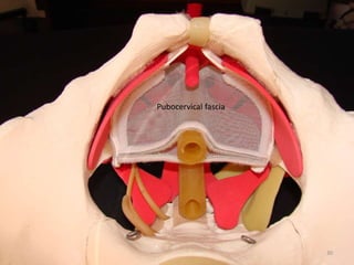 Pubocervical fascia
30
 