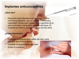 Implantes anticonceptivos
¿Qué son?
• Pequeños tubos flexibles impregnados con una
hormona progestina, que un médico o enfermera
capacitado inserta justo debajo de la superficie de la
piel en el interior de la parte superior del brazo. El
implante es efectivo durante un lapso de tres años
¿Cómo funcionan?
• Engrosan la mucosa en el cuello del útero para
dificultar que entre el semen
• Cambian el revestimiento del útero
• Evitan la ovulación
 