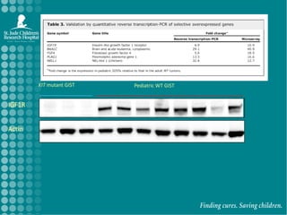 KIT mutant GISTPediatric WT GISTIGF1RActin