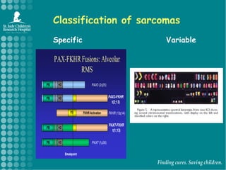 Classification of sarcomasSpecificVariable