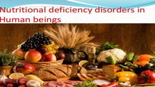 NUTRITIONAL DEFICIENCY DISORDERS IN HUMAN BEINGS