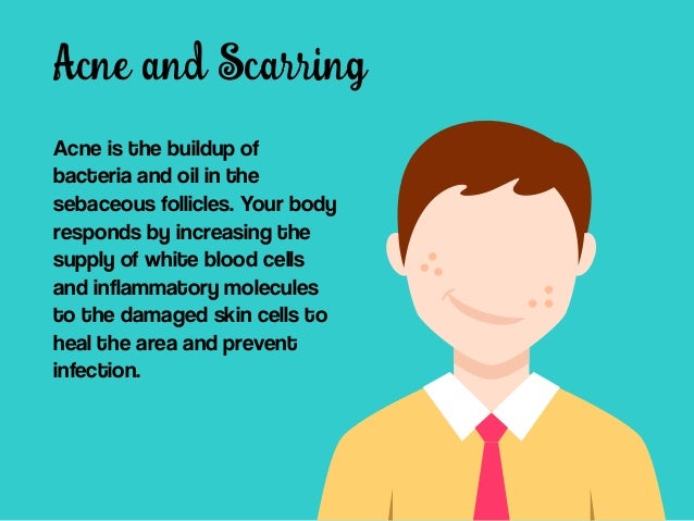 17 Best Tips On How To Heal Acne Scars Permanently